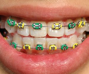 Link to more info about Orthodontic Dentistry